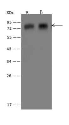 Western Blot APBA3/Mint-3 Antibody