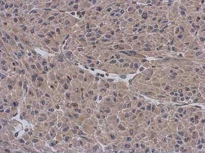 Immunohistochemistry-Paraffin: APBB3 Antibody [NBP1-33014] - Paraffin-embedded U87 xenograft, using antibody at 1:500 dilution.