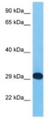 Western Blot: APBB3 Antibody [NBP3-10783] - Western blot analysis of APBB3 in Human 293T Whole Cell. Antibody dilution at 1 ug/mL