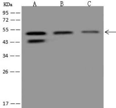 Western Blot: APBB3 Antibody [NBP3-12680] - Lane A: HeLa Whole Cell LysateLane B: A431 Whole Cell LysateLane C: 293T Whole Cell LysateLysates/proteins at 30 ug per lane.SecondaryGoat Anti-Rabbit IgG (H+L)/HRP at 1/10000 dilution.Developed using the ECL technique.Performed under reducing conditions.Predicted band size:53 kDaObserved band size:53 kDa(We are unsure as to the identity of these extra bands.)