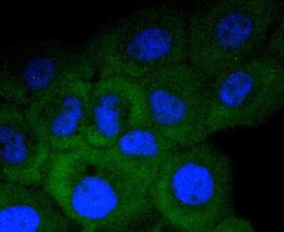 Immunocytochemistry/Immunofluorescence: APC Antibody (SC61-03) [NBP2-67625] - Staining APC in A431 cells (green). The nuclear counter stain is DAPI (blue). Cells were fixed in paraformaldehyde, permeabilised with 0.25% Triton X100/PBS.