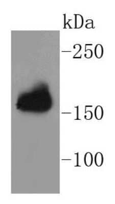 Western Blot: APC Antibody (SC61-03) [NBP2-67625] - Analysis of APC on mouse brain lysates using anti-APC antibody at 1/1,000 dilution.