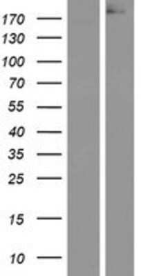Western Blot: APC Overexpression Lysate (Adult Normal) [NBP2-09450] Left-Empty vector transfected control cell lysate (HEK293 cell lysate); Right -Over-expression Lysate for APC.
