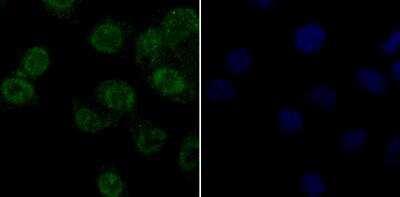 Immunocytochemistry/Immunofluorescence: APE Antibody (12H1) [NBP2-76919] - ICC staining APE1 in A549 cells (green). Formalin fixed cells were permeabilized with 0.1% Triton X-100 in TBS for 10 minutes at room temperature and blocked with 1% Blocker BSA for 15 minutes at room temperature. Cells were probed with APE1 monoclonal antibody at a dilution of 1:50 for 1 hour at room temperature, washed with PBS. Alexa Fluorc 488 Goat anti-Mouse IgG was used as the secondary antibody at 1/100 dilution. The nuclear counter stain is DAPI (blue).