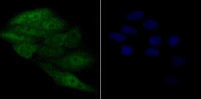 Immunocytochemistry/Immunofluorescence: APE Antibody (12H1) [NBP2-76919] - ICC staining APE1 in SiHa cells (green). Formalin fixed cells were permeabilized with 0.1% Triton X-100 in TBS for 10 minutes at room temperature and blocked with 1% Blocker BSA for 15 minutes at room temperature. Cells were probed with APE1 monoclonal antibody at a dilution of 1:50 for 1 hour at room temperature, washed with PBS. Alexa Fluorc 488 Goat anti-Mouse IgG was used as the secondary antibody at 1/100 dilution. The nuclear counter stain is DAPI (blue).