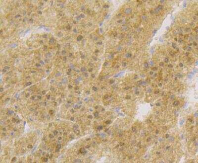 Immunohistochemistry: APE Antibody (12H1) [NBP2-76919] - Immunohistochemical analysis of paraffin-embedded human liver tissue using anti-APE1 antibody. The section was pre-treated using heat mediated antigen retrieval with sodium citrate buffer (pH 6.0) for 20 minutes. The tissues were blocked in 5% BSA for 30 minutes at room temperature, washed with ddH2O and PBS, and then probed with the antibody at 1/200 dilution, for 30 minutes at room temperature and detected using an HRP conjugated compact polymer system. DAB was used as the chrogen. Counter stained with hematoxylin and mounted with DPX.
