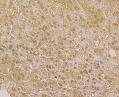 Immunohistochemistry: APE Antibody (12H4) [NBP2-76930] - Immunohistochemical analysis of paraffin-embedded human liver tissue using anti-APE1 antibody. The section was pre-treated using heat mediated antigen retrieval with sodium citrate buffer (pH 6.0) for 20 minutes. The tissues were blocked in 5% BSA for 30 minutes at room temperature, washed with ddH2O and PBS, and then probed with the antibody at 1/200 dilution, for 30 minutes at room temperature and detected using an HRP conjugated compact polymer system. DAB was used as the chrogen. Counter stained with hematoxylin and mounted with DPX.