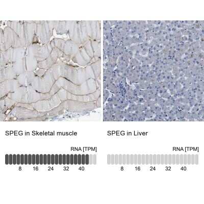 Immunohistochemistry-Paraffin: APEG1 Antibody [NBP1-90134] - Analysis in human skeletal muscle and liver tissues using NBP1-90134 antibody. Corresponding SPEG RNA-seq data are presented for the same tissues.