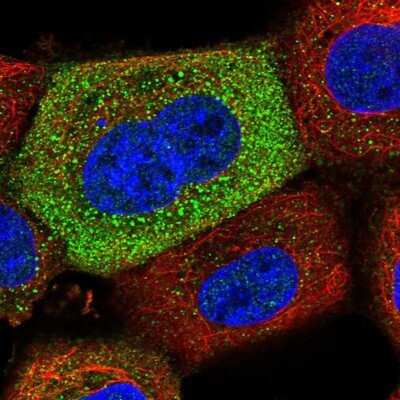 Immunocytochemistry/Immunofluorescence: APEH Antibody [NBP1-85331] - Staining of human cell line A-431 shows positivity in cytoplasm.