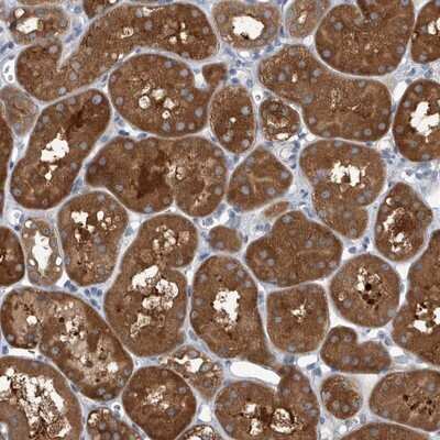 Immunohistochemistry-Paraffin: APEH Antibody [NBP1-85331] - Staining of human kidney shows strong cytoplasmic positivity in tubule cells.