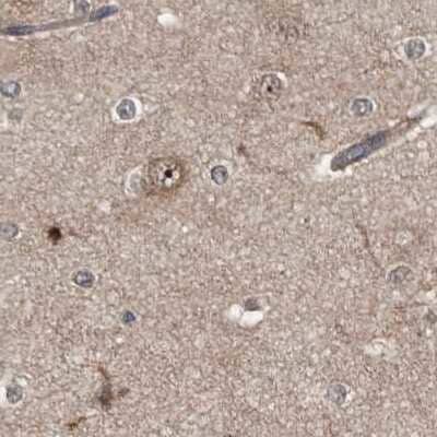 Immunohistochemistry-Paraffin: APEH Antibody [NBP1-85331] - Staining of human cerebral cortex.