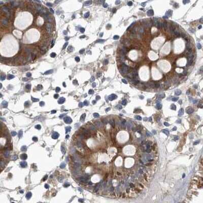 Immunohistochemistry-Paraffin: APEH Antibody [NBP1-85331] - Staining of human colon.