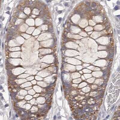 Immunohistochemistry-Paraffin: APEH Antibody [NBP1-85332] - Staining of human colon.