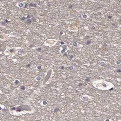 Immunohistochemistry-Paraffin: APEH Antibody [NBP1-85332] - Staining of human cerebral cortex.