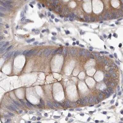 Immunohistochemistry-Paraffin: APEH Antibody [NBP1-85333] - Staining of human colon.