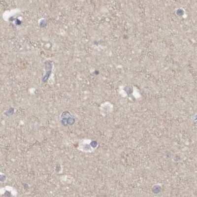 Immunohistochemistry-Paraffin: APEH Antibody [NBP1-85333] - Staining of human cerebral cortex.