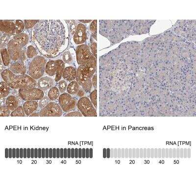 Immunohistochemistry-Paraffin: APEH Antibody [NBP1-85334] - Staining in human kidney and pancreas tissues using anti-APEH antibody. Corresponding APEH RNA-seq data are presented for the same tissues.