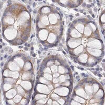 Immunohistochemistry-Paraffin: APEH Antibody [NBP1-85334] - Staining of human colon.