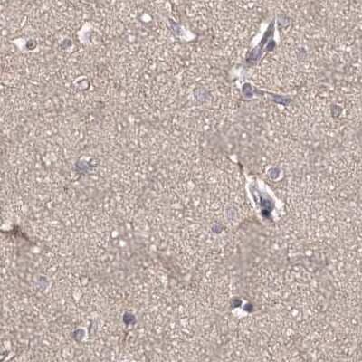 Immunohistochemistry-Paraffin: APEH Antibody [NBP1-85334] - Staining of human cerebral cortex.