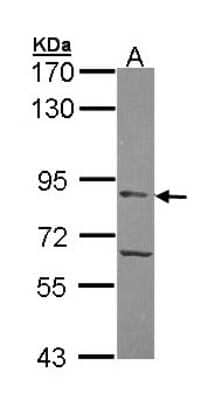 Western Blot: APEH Antibody [NBP1-33676] - Sample (30 ug of whole cell lysate) A: Hela 7. 5% SDS PAGE, antibody diluted at 1:500.