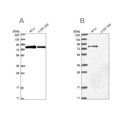 <b>Independent Antibodies Validation and Orthogonal Strategies Validation.</b>Western Blot: APEH Antibody [NBP1-85332] - Analysis using Anti-APEH antibody NBP1-85332 (A) shows similar pattern to independent antibody NBP1-85333 (B).