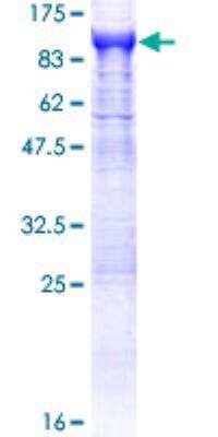 SDS-Page: APEH Recombinant Protein [H00000327-P01]