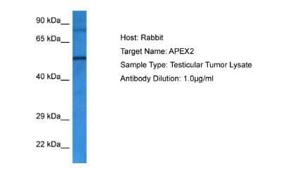 Western Blot: APEX2 Antibody [NBP2-84441] - Host: Rabbit. Target Name: APEX2. Sample Tissue: Human Testicular Tumor lysates. Antibody Dilution: 1ug/ml