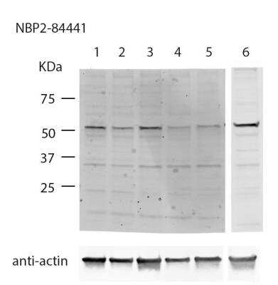 Western Blot: APEX2 Antibody [NBP2-84441] - Samples: lane 1-5: U2OS cell lysate, lanes 6 HEK293T cell lysate. Lane 1: non-targeting siRNA control, lane 2: APEX2_5 siRNA, lanes 3: APEX2_6 siRNA, lanes 4: APEX2_7 siRNA, lanes 5: APEX2_8 siRNA. Below: loading control, anti-actin mouse ab 1:5000. Western blot conditions: Cells were pelleted and lysed in RIPA buffer with protease inhibitors. Lysates were centrifuged at 16 000 g for 10 min and 9 ug of lysate was loaded in each lane on a 4-15% SDS-PAGE gel. Samples were transferred on a nitrocellulose membrane and blocked with 1.5% BSA O/N. NBP2-84441 antibody was diluted 1:500 (1 ug/ml) in TBST and incubated for 2 h. IImage from verified customer review.