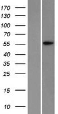 Western Blot: APEX2 Overexpression Lysate (Adult Normal) [NBP2-07324] Left-Empty vector transfected control cell lysate (HEK293 cell lysate); Right -Over-expression Lysate for APEX2.