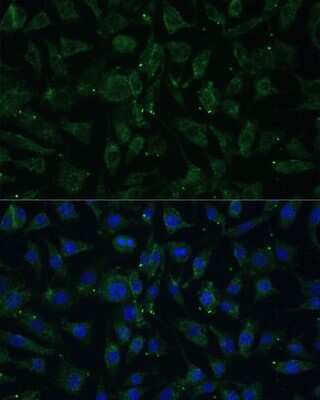 Immunocytochemistry/Immunofluorescence: APH1A Antibody [NBP2-92623] - Analysis of L929 cells using APH1A . Blue: DAPI for nuclear staining.