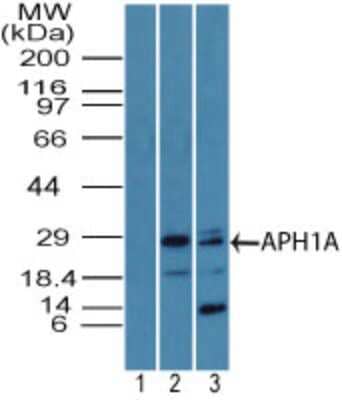 Western Blot: APH1a Antibody [NBP2-27176] - analysis of APH1A in 1) human lung lysate using prebleed at 1:5000, 2) human lung lysate using this antibody. I goat anti-rabbit Ig HRP secondary antibody and PicoTect ECL substrate solution were used for this test.