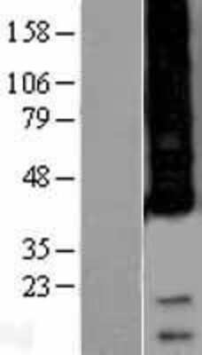 Western Blot: APH1a Overexpression Lysate (Adult Normal) [NBP2-04350] Left-Empty vector transfected control cell lysate (HEK293 cell lysate); Right -Over-expression Lysate for APH1a.