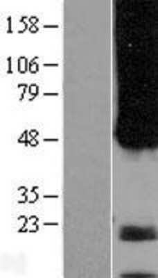 Western Blot: APH1a Overexpression Lysate (Adult Normal) [NBP2-08465] Left-Empty vector transfected control cell lysate (HEK293 cell lysate); Right -Over-expression Lysate for APH1a.