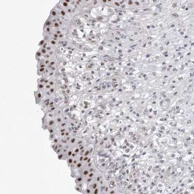 Immunohistochemistry-Paraffin: API5 Antibody [NBP1-89326] - Staining of human urinary bladder shows strong nuclear positivity in urothelial cells.