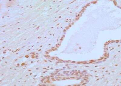 Immunohistochemistry-Paraffin: APIP Antibody (19F461) - Azide Free [NBP2-33231] - Analysis of APIP in a section of normal prostate from human using 5 ug/ml concentration of APIP antibody (clone 19F461). The tubuloalveolar glands in prostate section depicted APIP positivity in the cytoplasm and nuclei of the epithelial cells. The fibro-muscular stroma showed an overall weak staining with intense nuclear positivity in some cell