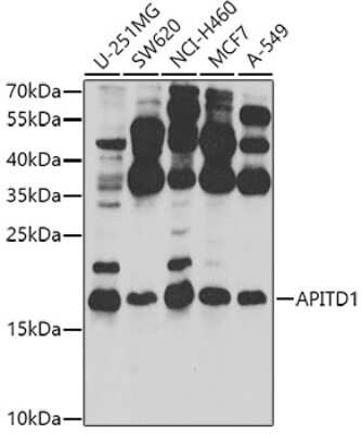 Western Blot: APITD1 Antibody [NBP2-92534] - Analysis of extracts of various cell lines, using APITD1 at 1:1000 dilution.Secondary antibody: HRP Goat Anti-Rabbit IgG (H+L) at 1:10000 dilution.Lysates/proteins: 25ug per lane.Blocking buffer: 3% nonfat dry milk in TBST.Detection: ECL Basic Kit .Exposure time: 30s.