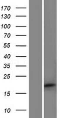 Western Blot: APITD1 Overexpression Lysate (Adult Normal) [NBP2-10083] Left-Empty vector transfected control cell lysate (HEK293 cell lysate); Right -Over-expression Lysate for APITD1.