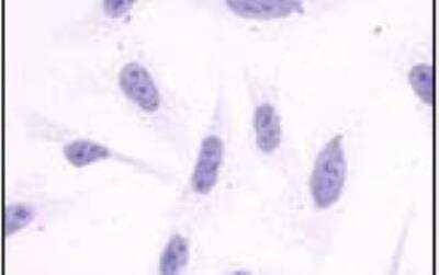 Immunocytochemistry/Immunofluorescence: APJ/Apelin receptor Antibody [NLS65] - Staining of untransfected HEK293 human embryonic kidney cells.