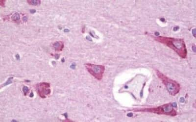 Immunohistochemistry-Paraffin: APJ/Apelin receptor Antibody [NBP3-14541] - Immunohistochemistry of formalin-fixed, paraffin-embedded human brain, cortex.