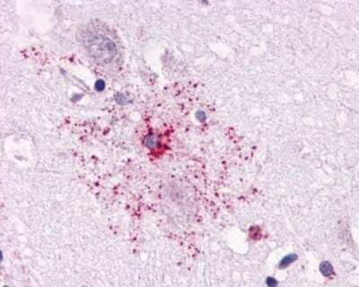 Immunohistochemistry-Paraffin: APJ/Apelin receptor Antibody [NLS63] - Analysis of anti-Apelin Receptor antibody with human brain, astrocyte.