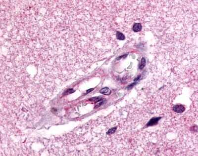 Immunohistochemistry-Paraffin: APJ/Apelin receptor Antibody [NLS65] - Analysis of anti-Apelin Receptor antibody with human brain, vessels.
