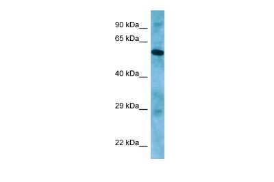 Western Blot: APLF Antibody [NBP2-84442] - WB Suggested Anti-APLF Antibody. Titration: 1.0 ug/ml. Positive Control: PANC1 Whole Cell