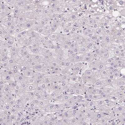 Immunohistochemistry-Paraffin: APLP-1 Antibody [NBP2-38140] - Staining of human liver shows no positivity in hepatocytes as expected.