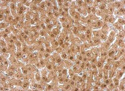 Immunohistochemistry-Paraffin: APLP-2 Antibody [NBP1-32814] - Mouse liver dilution: 1:500. Antigen Retrieval: TrilogyTM (EDTA based) buffer, 15min