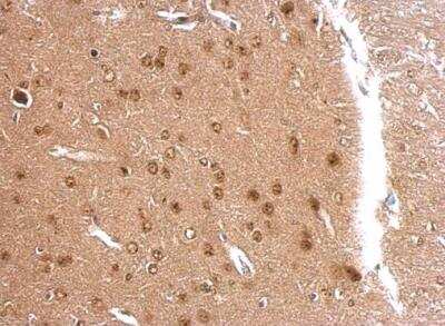 Immunohistochemistry-Paraffin: APLP-2 Antibody [NBP1-32814] - Mouse fore brain dilution: 1:500. Antigen Retrieval: TrilogyTM (EDTA based) buffer, 15min