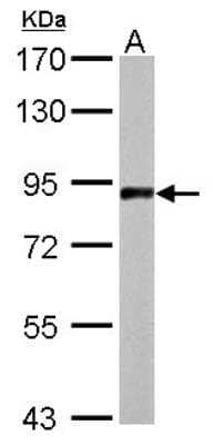 Western Blot: APLP-2 Antibody [NBP1-32814] -  50 ug mouse brain lysate/extract 7. 5 % SDS-PAGE gel, antibody dilution 1:1000.