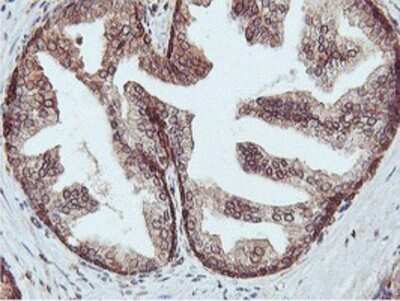 Immunohistochemistry: APMAP Antibody (OTI4F6) - Azide and BSA Free [NBP2-72080] - Staining of paraffin-embedded Human prostate tissue using anti-APMAP mouse monoclonal antibody.