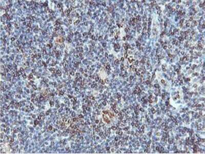 Immunohistochemistry: APMAP Antibody (OTI4F6) - Azide and BSA Free [NBP2-72080] - Staining of paraffin-embedded Human tonsil using anti-APMAP mouse monoclonal antibody.