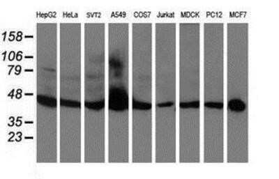 Western Blot: APMAP Antibody (OTI4F6) - Azide and BSA Free [NBP2-72080] - Analysis of extracts (35ug) from 9 different cell lines by using anti-APMAP monoclonal antibody.