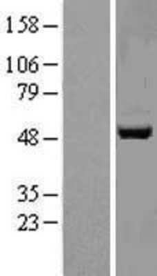 Western Blot: APMAP Overexpression Lysate (Adult Normal) [NBL1-08371] Left-Empty vector transfected control cell lysate (HEK293 cell lysate); Right -Over-expression Lysate for APMAP.